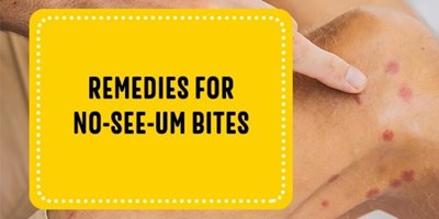 Remedies for No-See-Um Bites